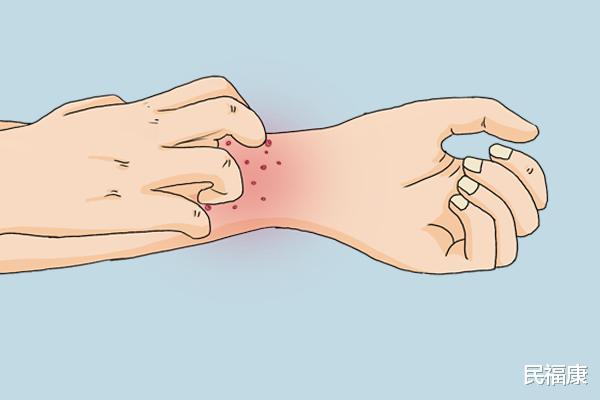 糖尿病|别把癌症误认为皮肤病! 皮肤出现这六种特征，别拖，请尽快就医