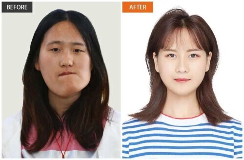 话晴空|23岁“歪脸女孩”脱胎换骨惊艳众人，拒绝当网红，想圆人民教师梦