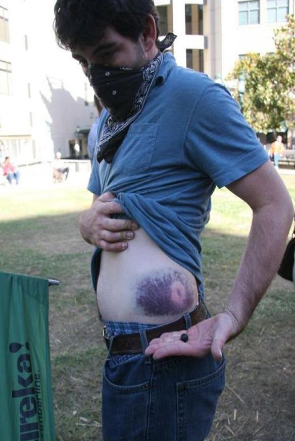 @被橡胶子弹打中就像挠痒痒?其实电视演错了!真实案例告诉大家答案