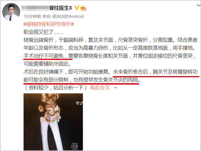 谢楠|吴京妻子谢楠粉碎性骨折，专业医生解读伤情：高暴力导致