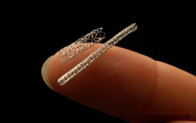 心脏支架|心脏支架手术后，还可以活多久？医生终于给出准确答案，早做准备