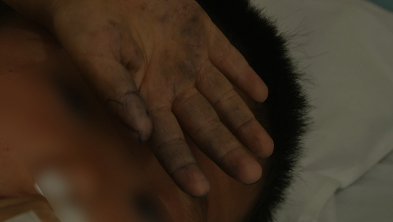 「中毒」警惕！四个男孩路边呕吐，一人陷入昏迷！就因为摘了这个吃