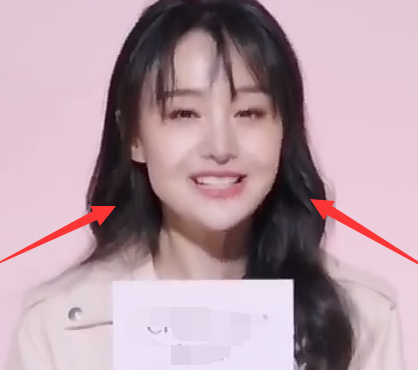 [郑爽]别人想削腮，看到郑爽的“原装脸”，才懂什么叫高级美