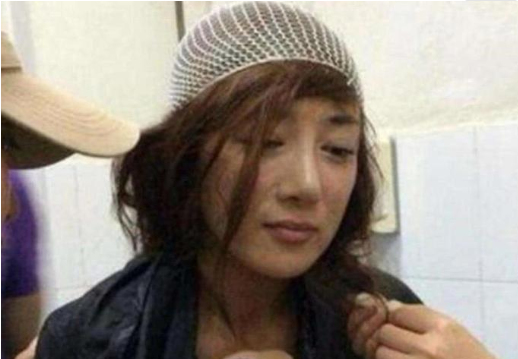 #毁容#她曾是“古装第一美人”，却被著名女星的狗咬伤毁容，整容5次仍翻不了身！