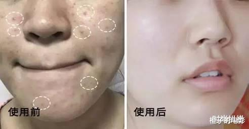 洗面奶|被列入“黑名单”的几款洗面奶，皮肤越洗越糟，有就赶快扔了吧！