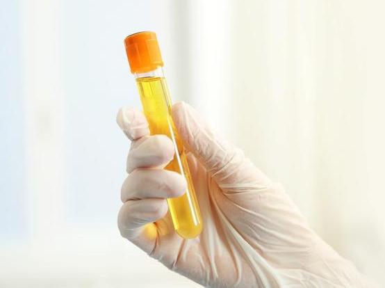 排毒▲34岁男子，尿酸高达810，肾衰入院，医生无奈：怎能拿它当水喝