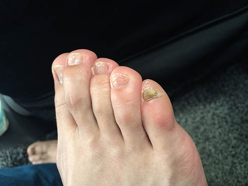 肝功能■脚上一旦出现这“3个现象”,证明“肝功能”变差,早做CT