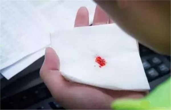 『』肺癌早期的体征与常见表现