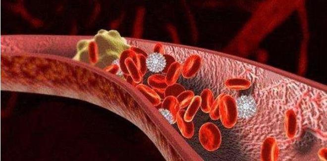 【红薯】长期早餐吃红薯，对身体是好是坏？可能与你想的不一样