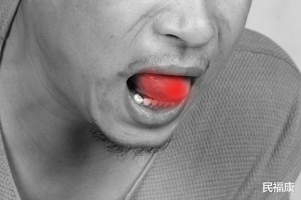 脾胃|脾胃不好，外表能看出来，脸、眼睛、身材、舌头，分别有啥异常？