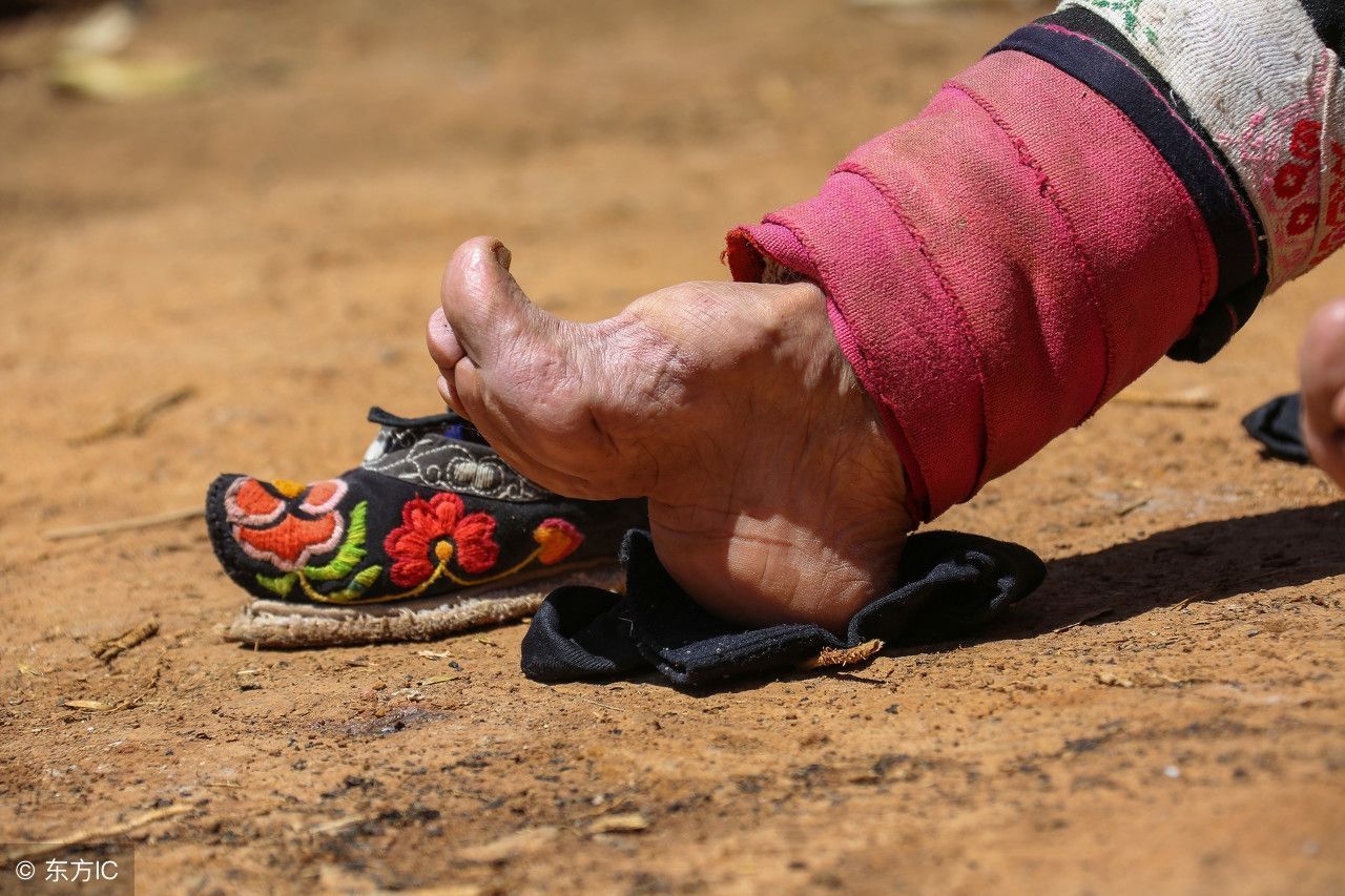 历史揭秘|延续千年的缠足对于女性的残害有多深？揭秘三寸金莲的血泪史。