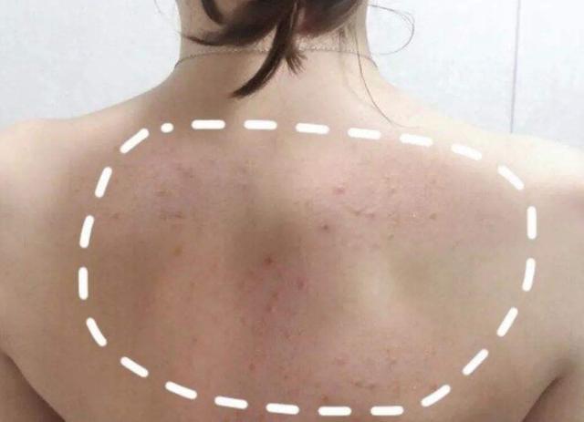 熬夜|吸烟者注意：若这些部位出现肿块，那很可能是肺对你喊“救命”了