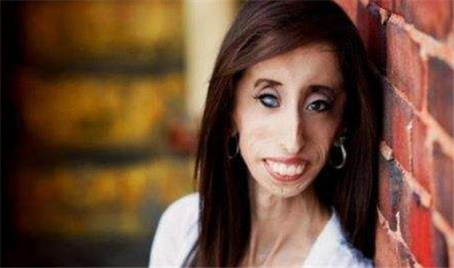 「卡路里」7年前,那位每天吃60顿饭,体重仍只有50斤的女孩,如今活成了这样