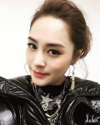 阿娇|阿娇凌晨头部意外受伤：伤势严重已紧急送医，容祖儿正赶往厦门