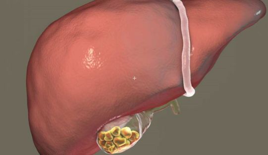 肝硬化|肝变“硬”之前，会发出3个信号，经常做3件事，悄悄逼走肝硬化