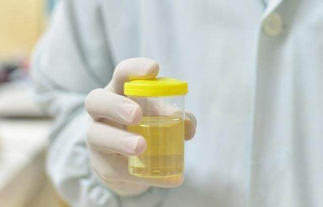 尿毒症|尿毒症“登门”，可能会向身体发出3个“信号”，很多人都忽略了