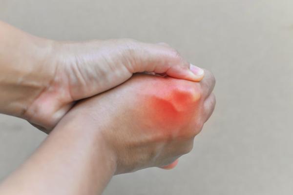 痛风|从不喝酒也不常吃海鲜，却被痛风折磨很惨？厨房“四味”或是元凶