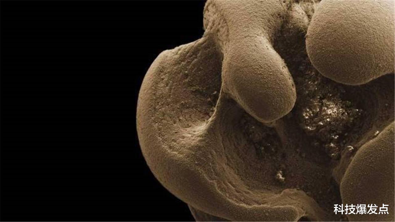 科学家|科学家发现以金属为食的细菌,百年前的预言,终于得到证实!