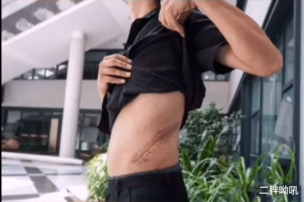 [苹果]8年前卖肾换苹果4的小伙怎么样了？一米九只有90斤，苹果4现仅值50