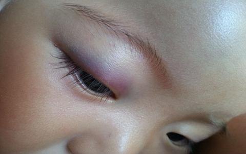 【】湿气重，人体三处会鼓起来！你知道吗？