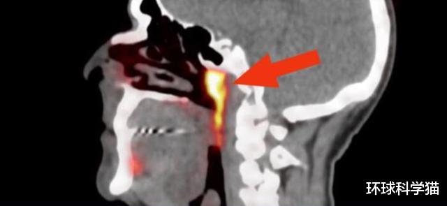 科学家|人类进化没有停?科学家或发现“此前未知”的器官,隐藏很好