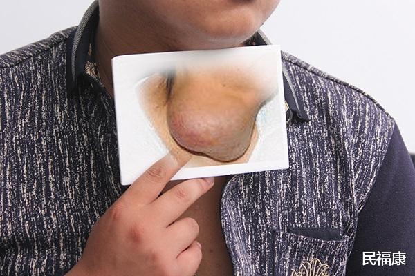 胰腺癌|癌症也分“善恶”，碰上这3种癌症，治愈难度很大，要尽早治疗