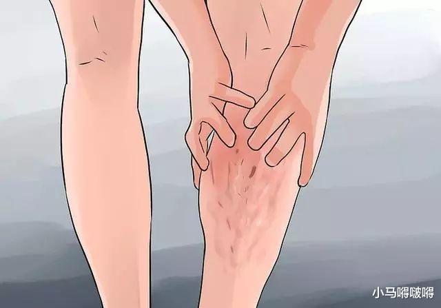 「脂肪酸」48岁男子，背痛了一天，骤然离世，医生措手不及，这病真的太凶险