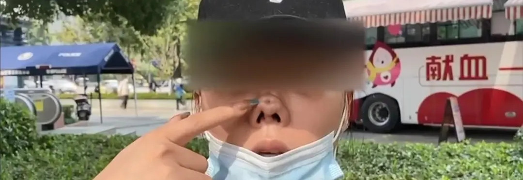 整形|女主播花2万整鼻子,竟把鼻子整出4个洞,看完我要开始撸铁了