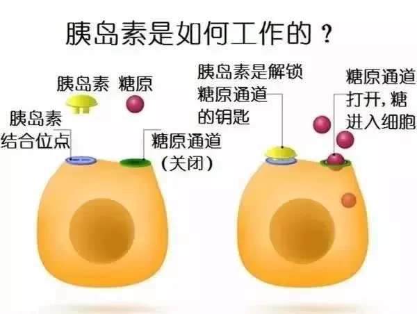 【血糖】他是伴随糖尿病全过程，是导致糖尿病并发症的罪魁祸首，注意调整这一点