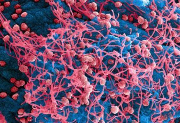 『科学家』哈佛科学家：4种方式可能终结新冠病毒，大流行结束或快于预期！