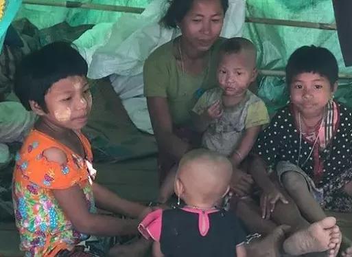 緬甸克欽邦武裝控制區難民面臨食物短缺問題-圖4