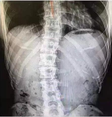 健身@44岁金钟国健身20年,却被医生告知肾功能低下!网友:药用多了?