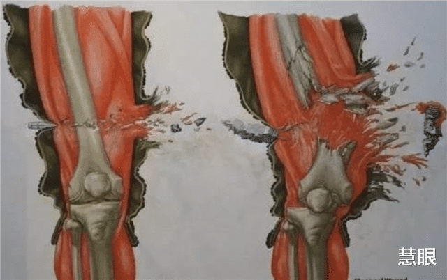 ▲子弹为什么能打死人?当你看到这个就啥都明白了!