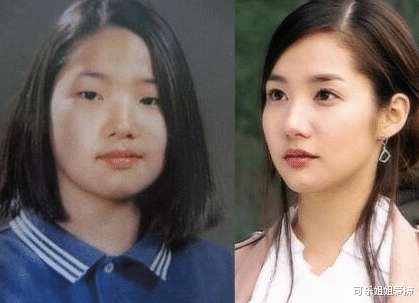 整容|因整容走上颜值巅峰，14年却不见手术后遗症，如今美成整容模板