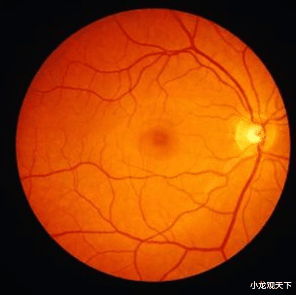 ▲专家: 人类并未进化完全, 身上还有5个“漏洞”, 你知道几个?