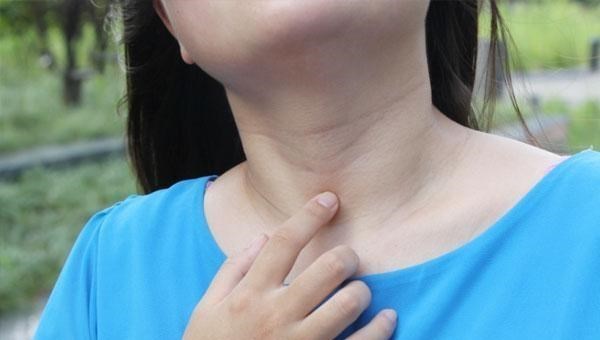 冬瓜|体内有癌，嗓子往往会出现2点“异象”，一旦出现，最好查一查