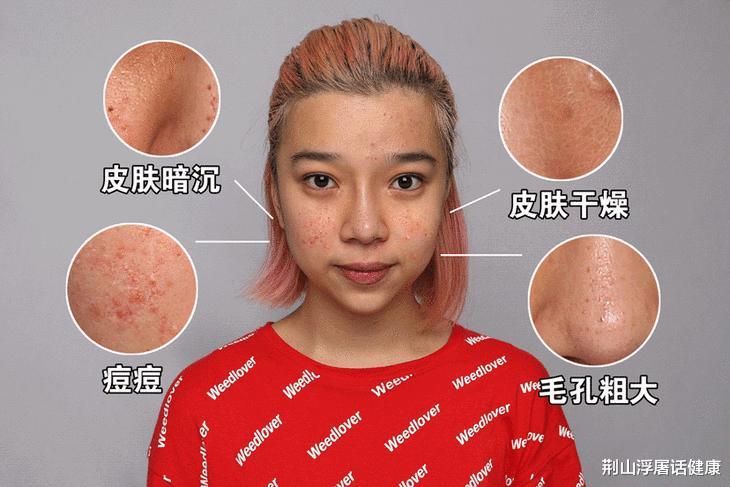 肝脏|35岁女子,胸前长出小红点,医生:再来晚一点,癌就上身了