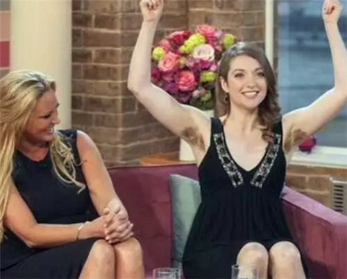 『』她是“体毛”最长的女性,曾打破吉尼斯纪录,剃掉毛后,美丽动人