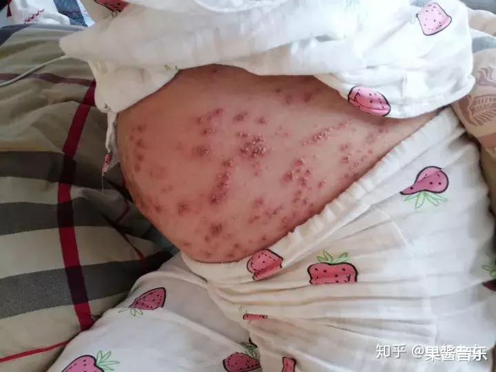 「郭碧婷」郭碧婷怀孕偷拍照首曝光，我看到了女人最难以启齿的一面