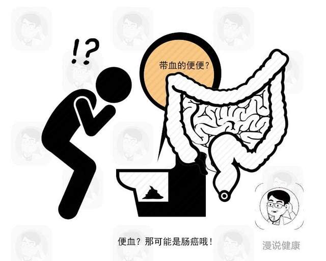 肠癌|大肠出现癌细胞，往往排便有这4大共性！年过40岁劝你悠着点