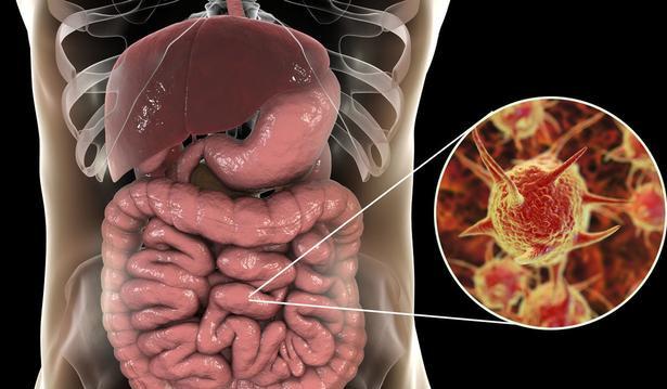 排毒@提醒你：身体3个地方发臭，是肠道在求救，别等熬成癌了再后悔