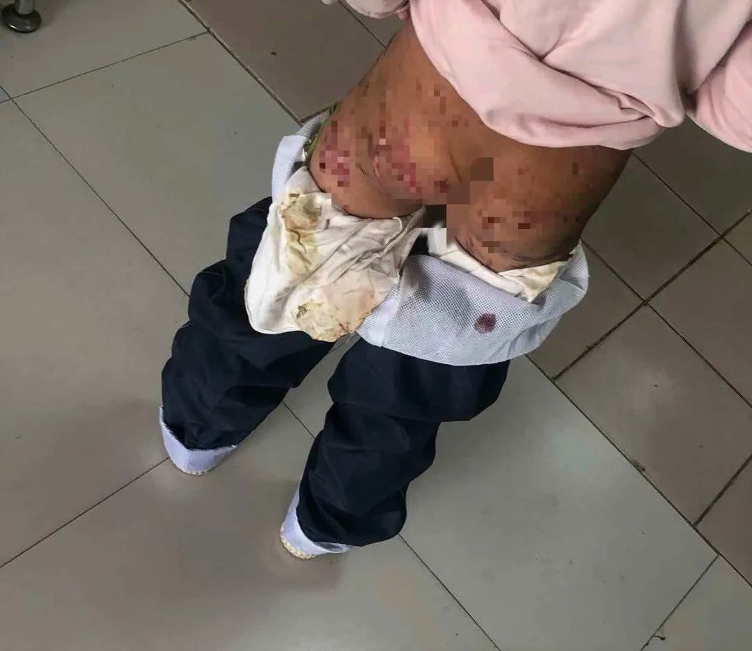 合肥|不敢相信这是亲妈干的事！合肥警方深夜发声！