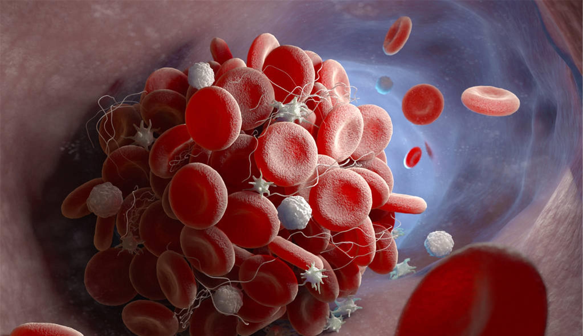 胆固醇|不想血液“粘稠如粥”？4物请撤离餐桌，管住嘴，血管干净不易堵