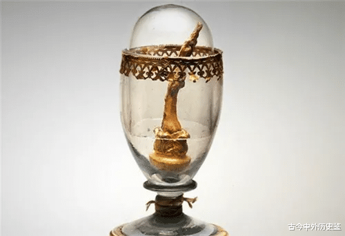 爱因斯坦▲5位世界名人保留下来的遗物，爱因斯坦的大脑，爱迪生最后一口气