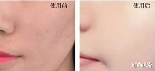 「刘雯」32岁刘雯被曝谈恋爱，曾坦言：工作是自己的男朋友，爱自己就够了