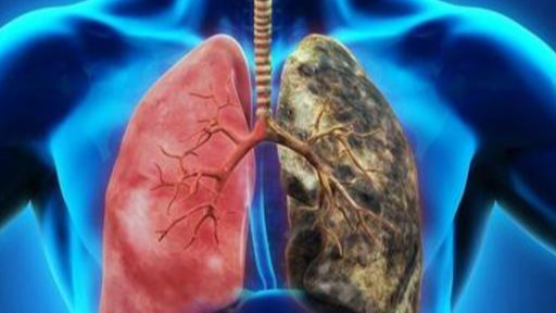 排便|每天吸烟的人，若身上这3个地方没“变粗”，恭喜你的肺还算健康