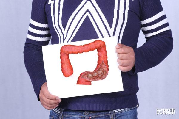 排便|肠道发生癌变，大便出现的反常迹象，很难藏住，别知道太晚