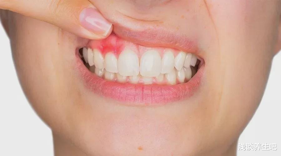 肝脏@保肝,四种食物一口不能碰,若你经常吃,肝脏十有八九已经病变了!