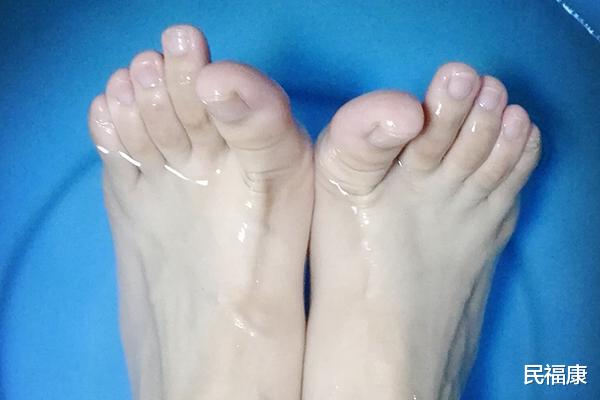 肝脏|肝不好脚先知，脚上接连出现哪些异常，提示肝出问题了？