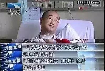 致癌物|每天1包，36岁男子要切舌保命！这果子被公认为强致癌物，却有数千万人爱吃